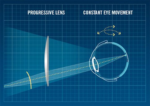 Progressive Lens